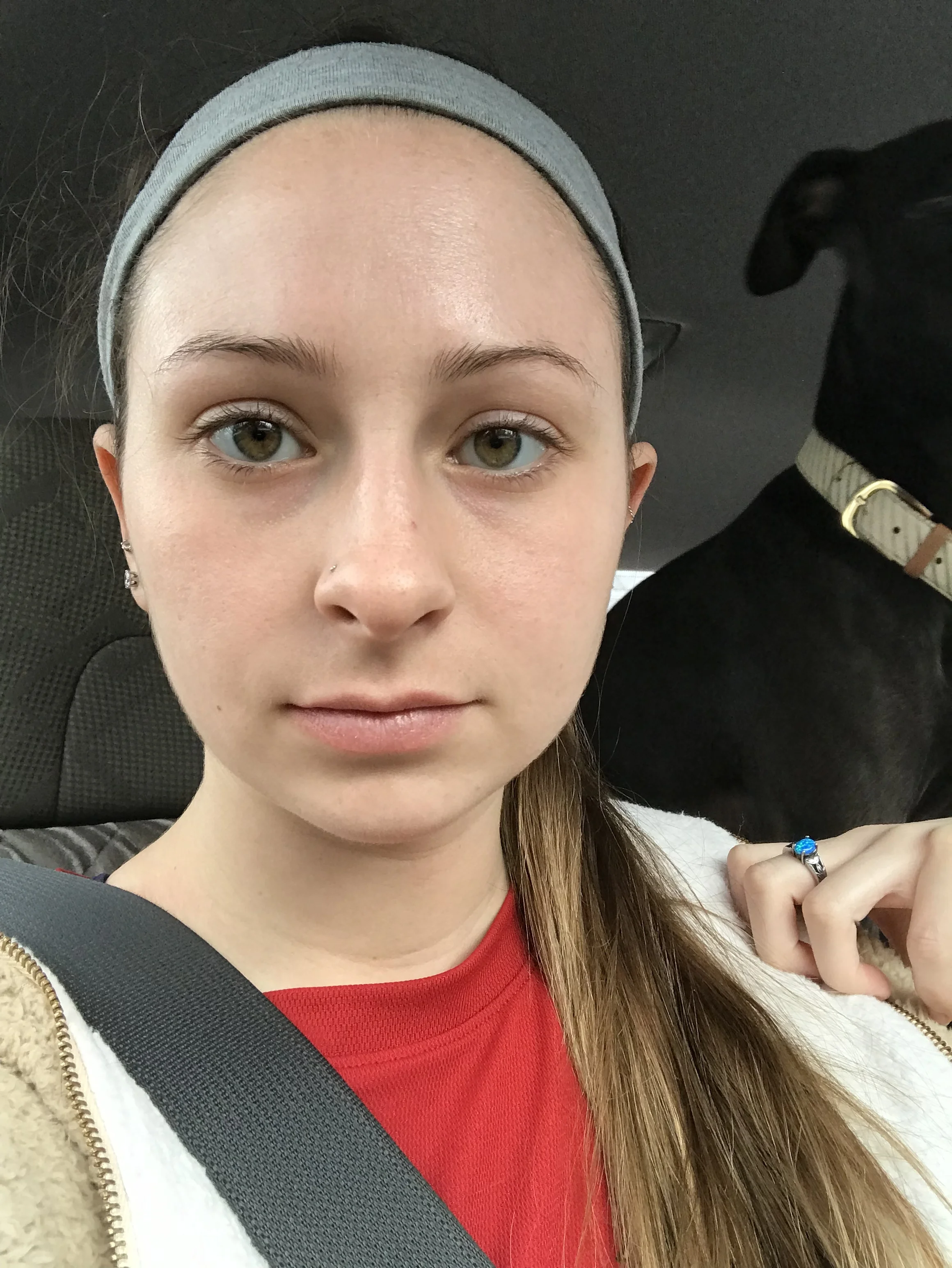 7 Days after I received the product!!! Looking so fresh and glowy.