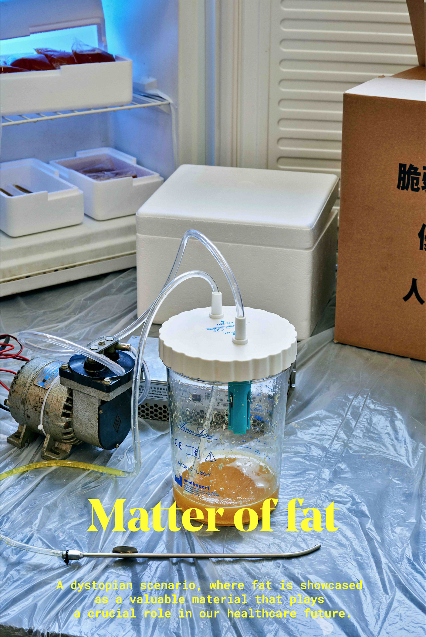 Matter of Fat is a dystopian scenario, where fat is extracted for its monetary and medical qualities. Indeed, it contains stem cells which can be grown into any kind of organs and costs on average $125 per gram. Current BioBank already proposes stor…