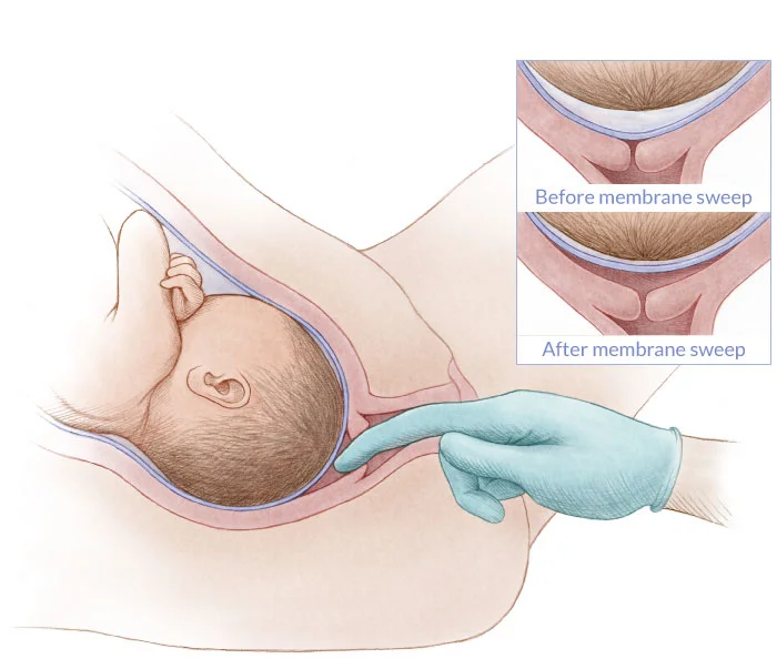 Photo from webmd.com