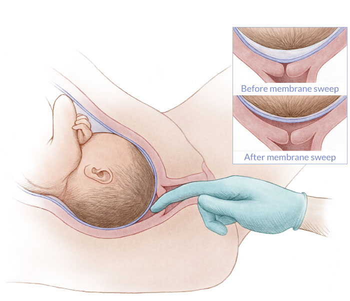 Photo from webmd.com