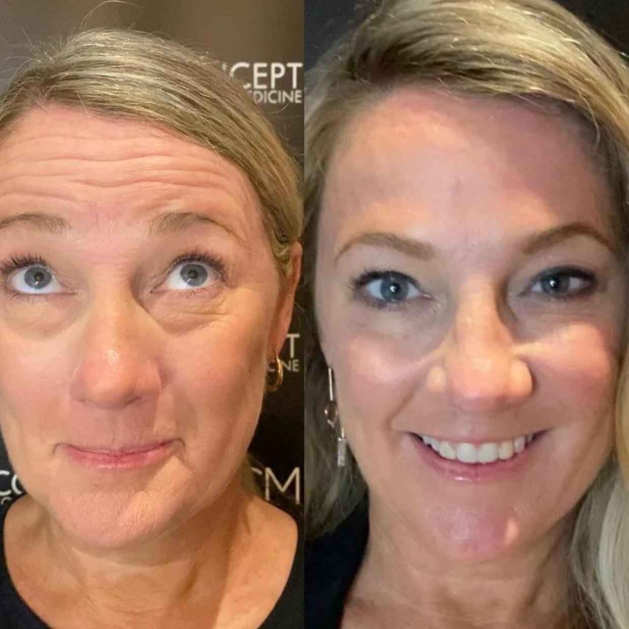 &ldquo;Fresh, not frozen! Dr. Stefan&rsquo;s ensures you retain your natural expression while achieving a youthful, rejuvenated look.

Contact us to make an appointment before Christmas or a consultation with with one of our medical staff.