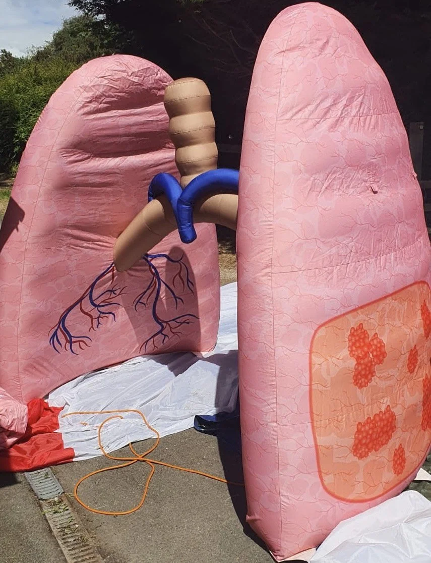 New Inflatable Lung for the NHS