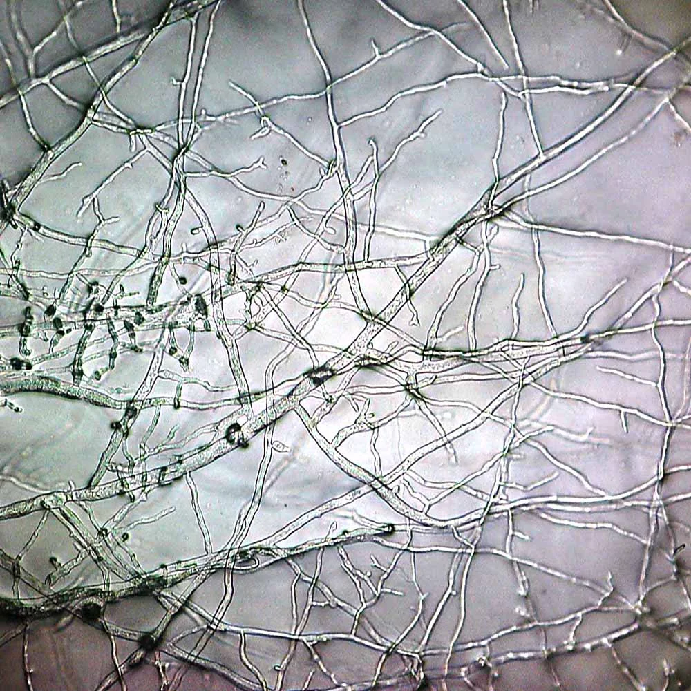 Hyphae.jpeg