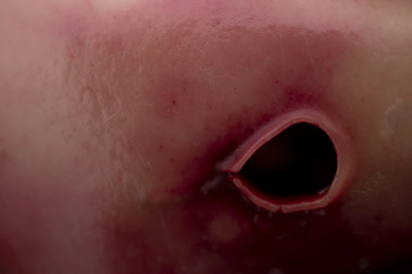 Fleshy orifice.jpg