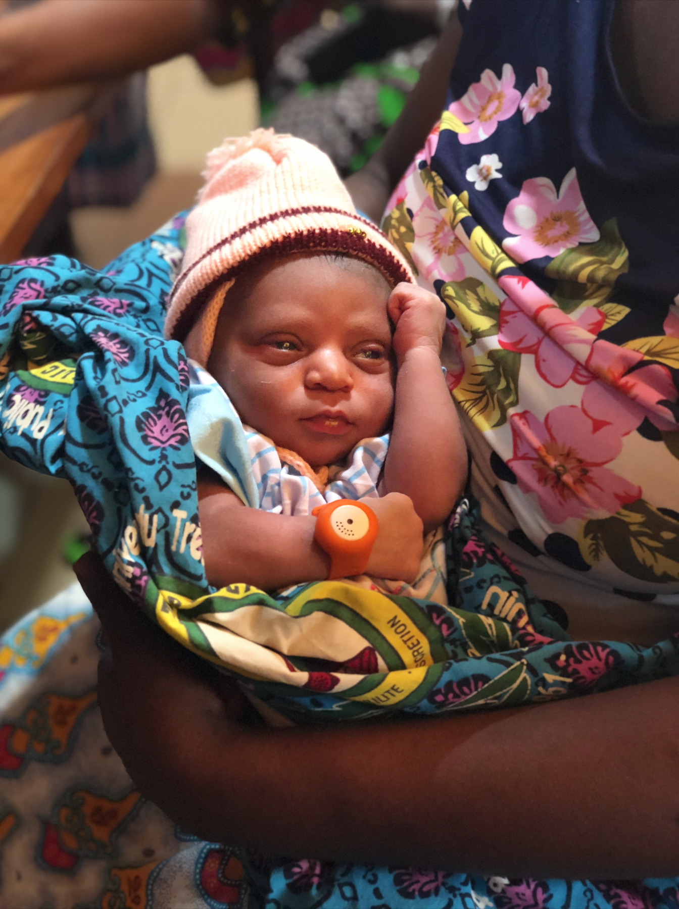 A baby from our UNICEF Benin pilot wearing the BEMPU TempWatch.