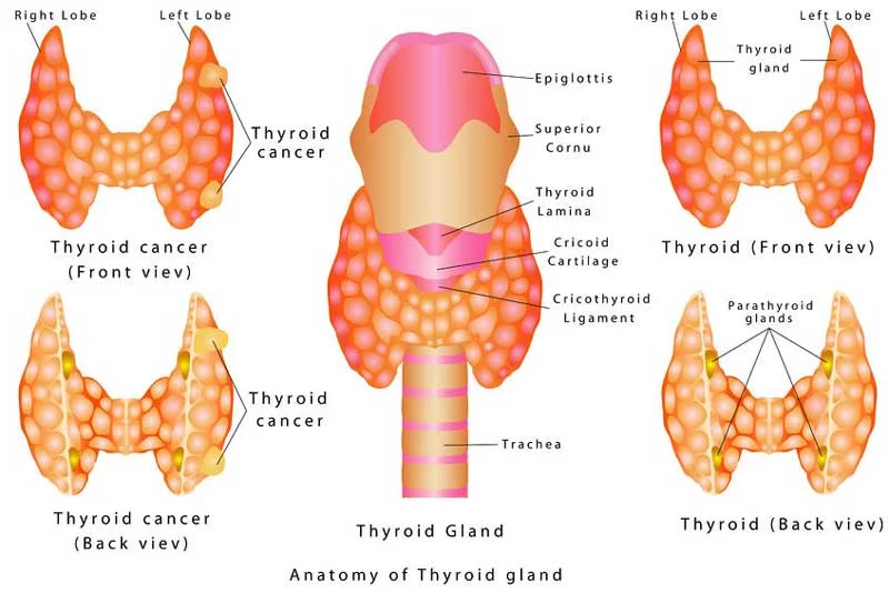 thyroid_cancer_anatomy-SS.jpg