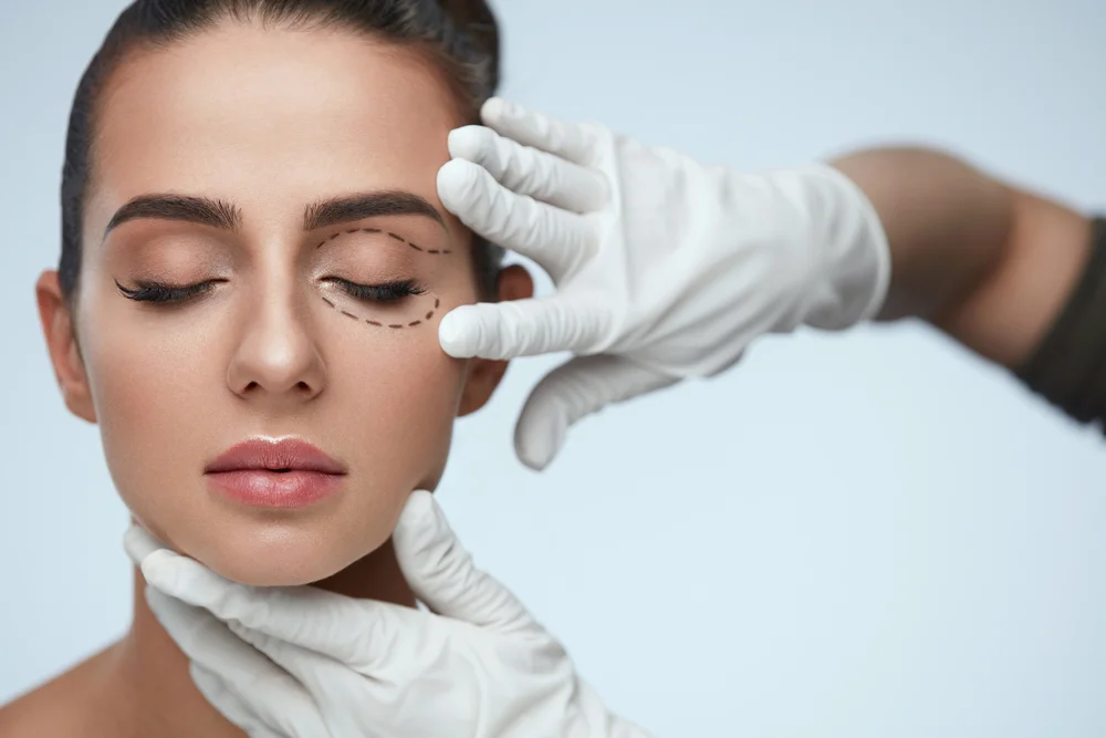 plastic eye surgery in OKC.jpg