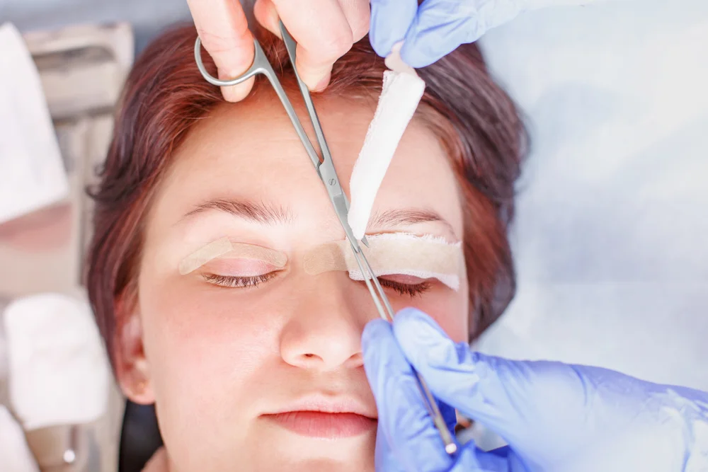 Things You cannot Miss about Blepharoplasty