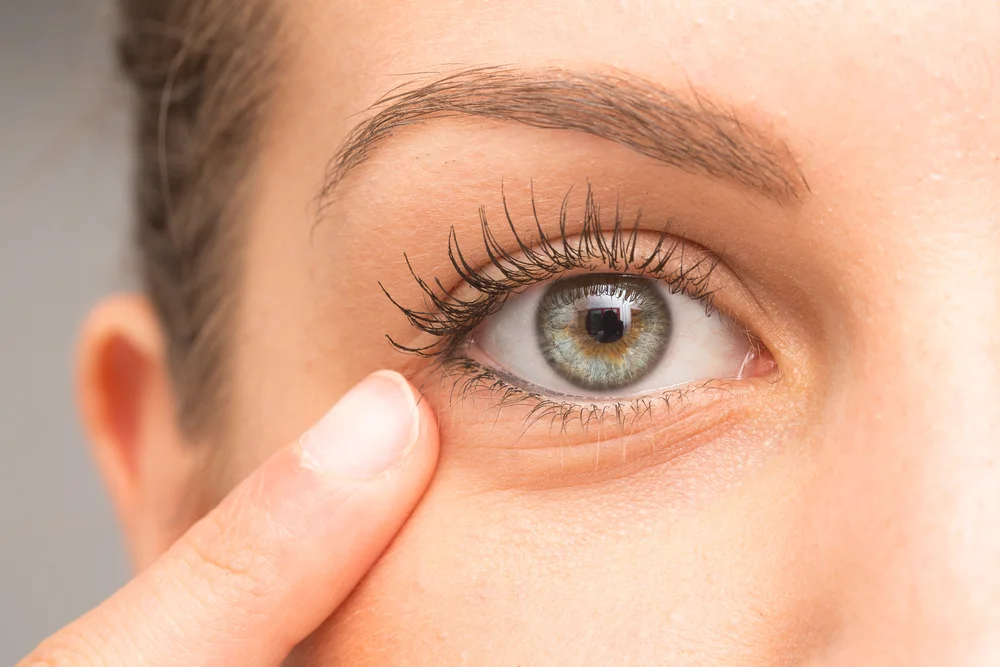 How to Take Care of Your Eyes After Blepharoplasty
