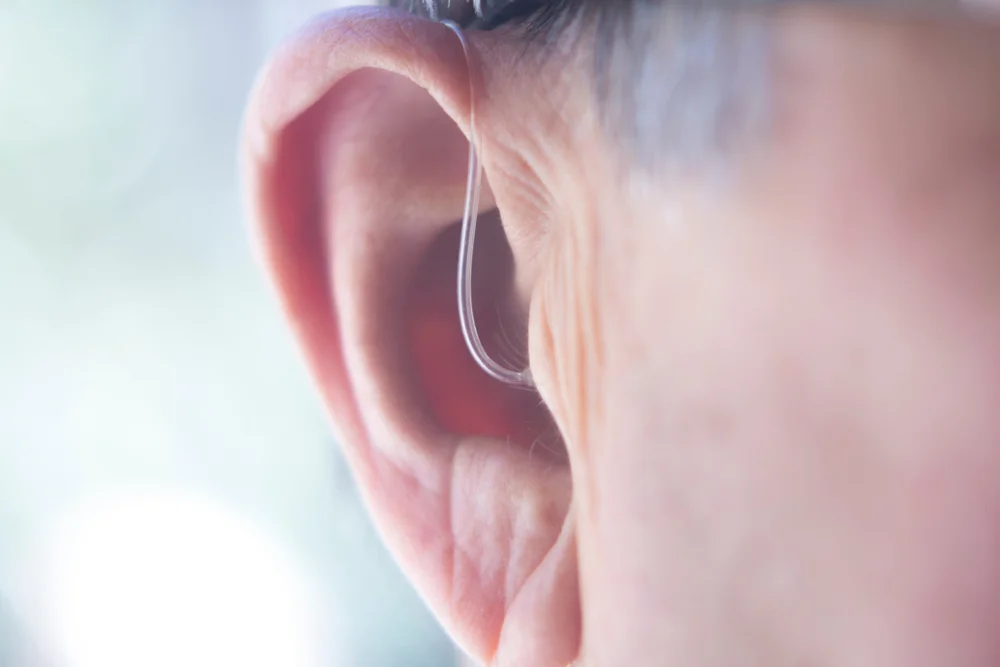 Hearing Aids – Is It for All?