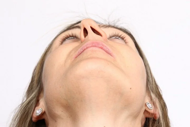 Not Fixing Deviated Septum – The Consequences