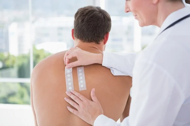 Why Skin Allergy Testing Is Important?