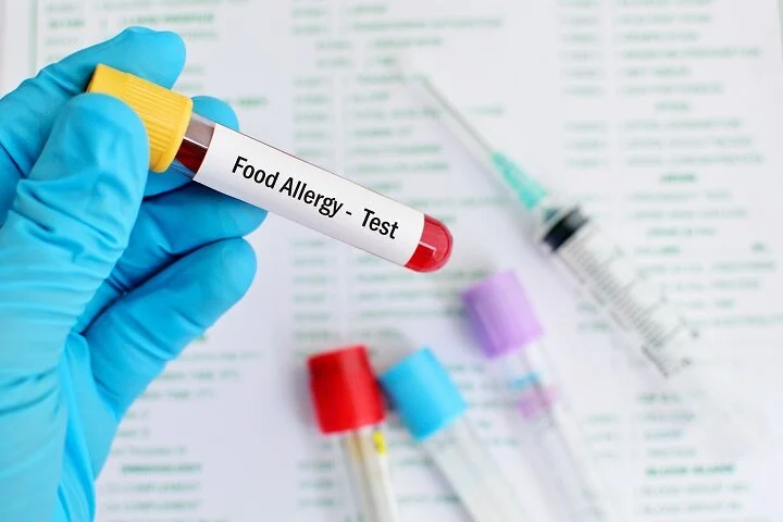 Why Is Food Allergy Testing Important?