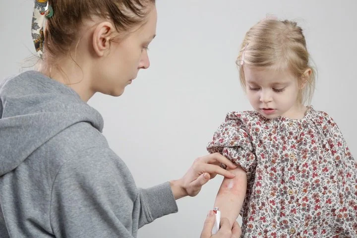 Eczema and Allergy Testing: What You Should Do for Your Kid?