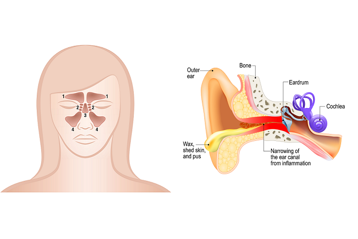 Basics about Ear Infection and Sinus Infection
