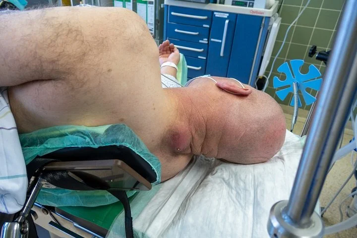 Neck Abscess: Symptoms &amp; Treatment Options