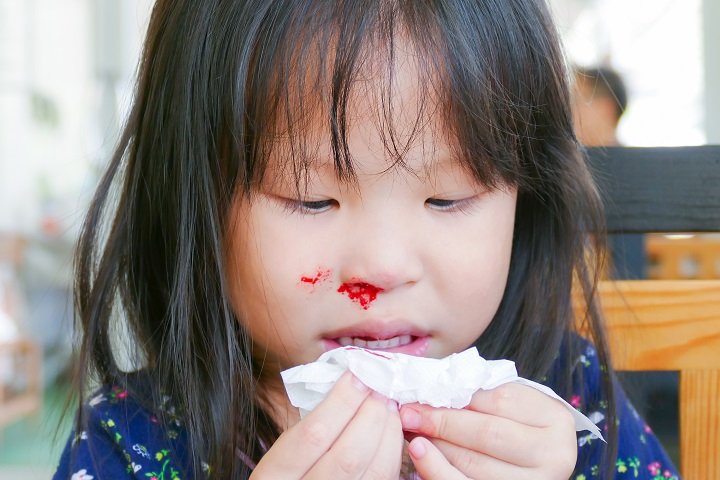 A Comprehensive Guide to Your Child’s Bloody Nose