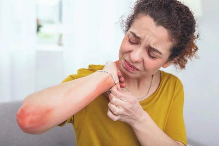 Does Metal Really Cause Allergy?