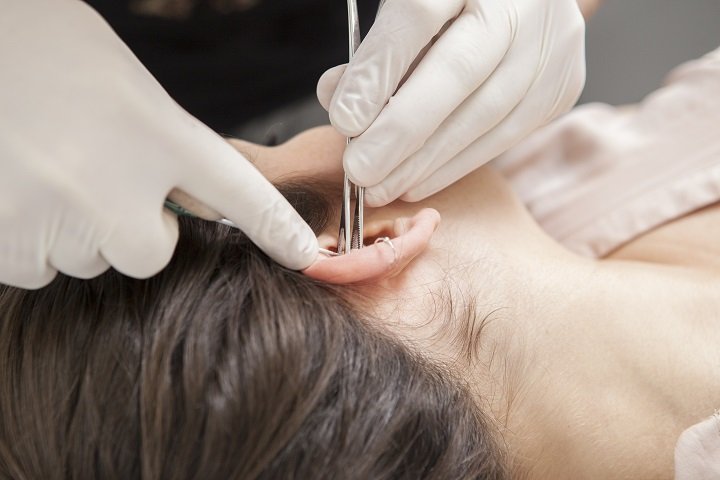 Do You Need to Have Ear Tubes Inserted?