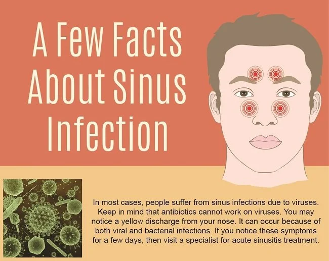 A Few Facts Of Sinus Infection