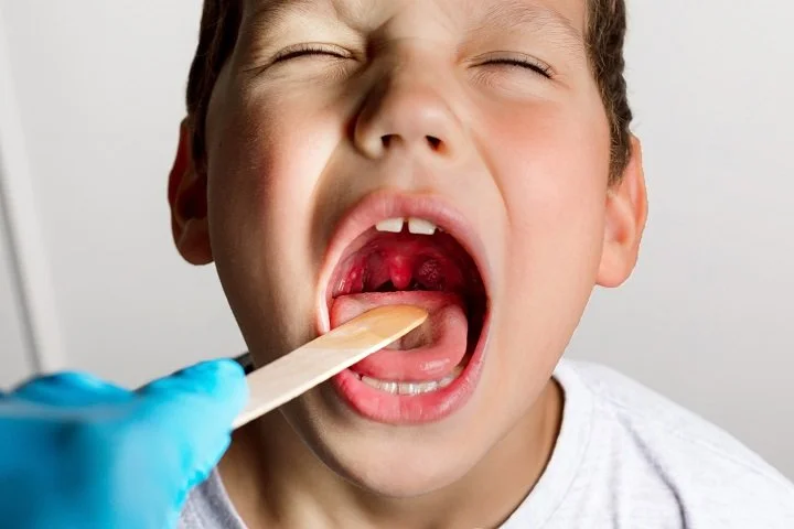 Reasons of Considering a Tonsillectomy for Your Child