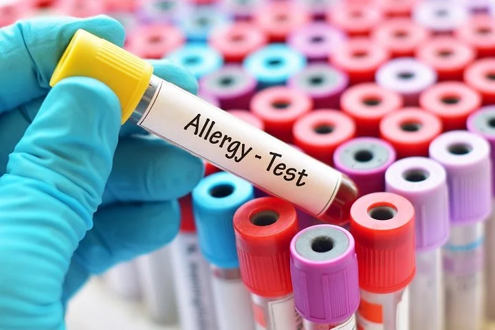 A Clear Guide to Hair and Blood Allergy Testing