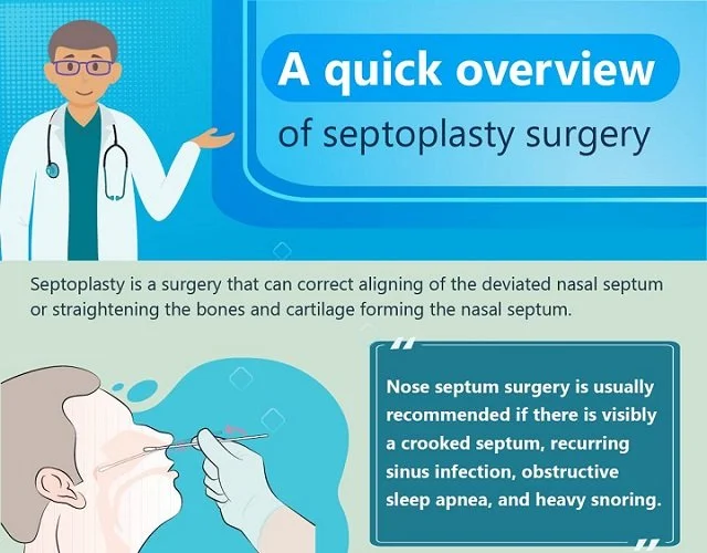 A Quick Overview Of Septoplasty Surgery