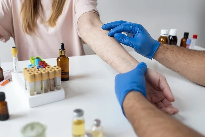 A Novice’s Guideline About Allergy Testing and Its Importance