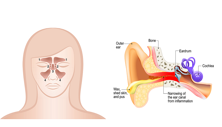Basics About Ear Infection And Sinus Infection basics-about-ear-infection-and-sinus-infection