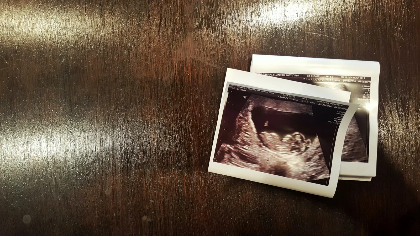 The Pregnant Entrepreneur: Part One (of Many)