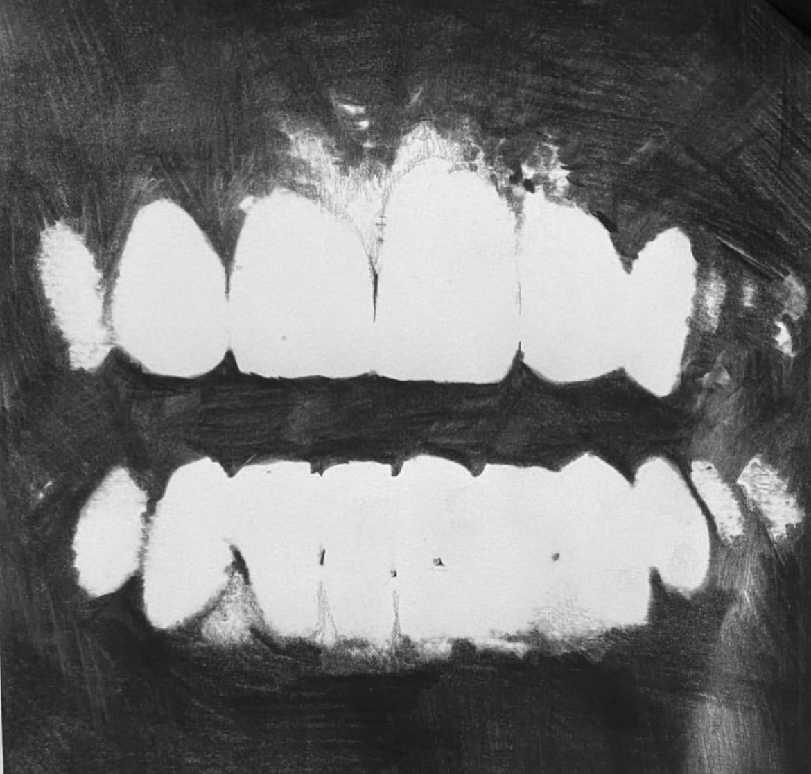 Teeth III