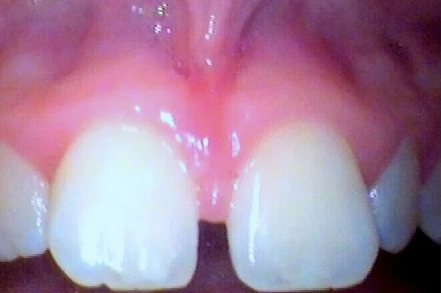 tongue_2.jpg