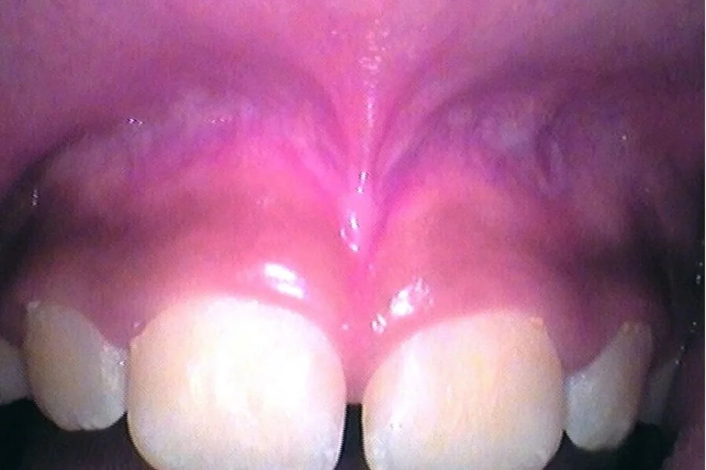 tongue_14.jpg