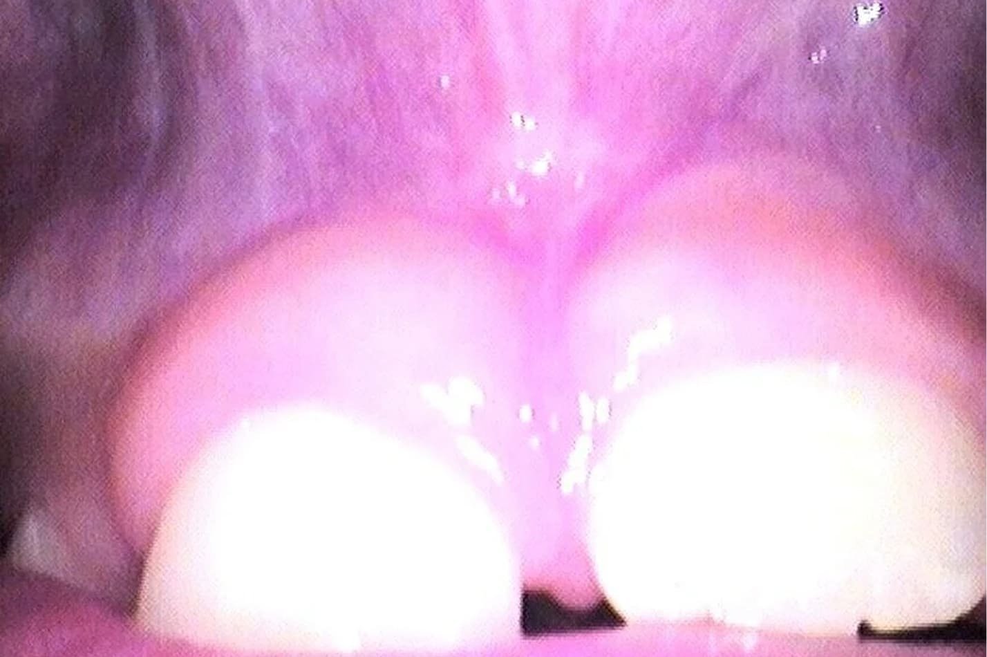 tongue_8.jpg