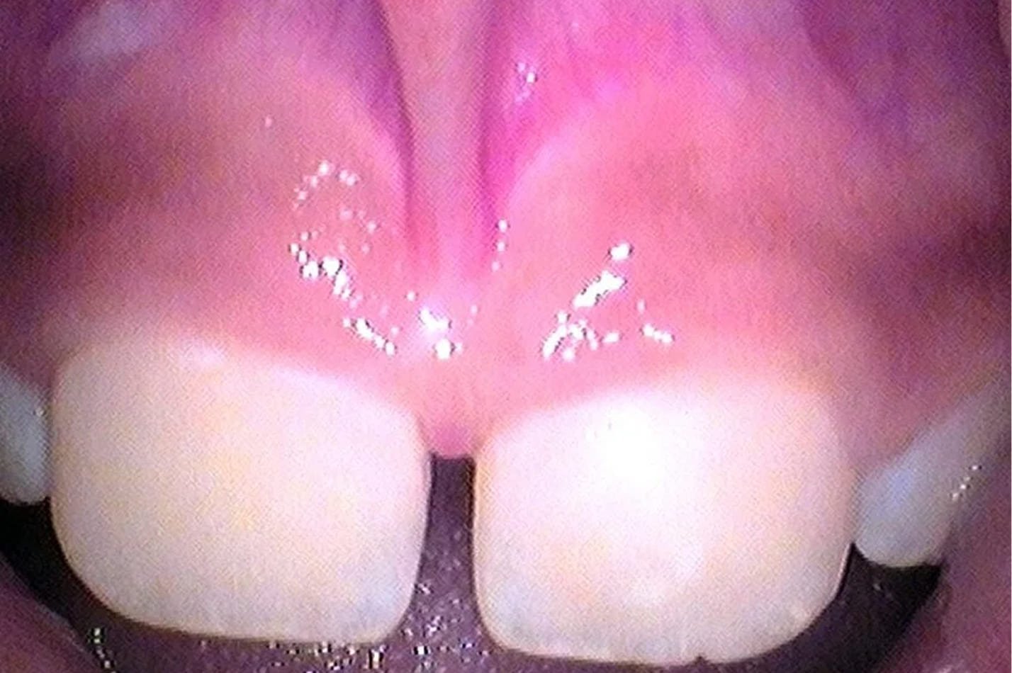 tongue_13.jpg