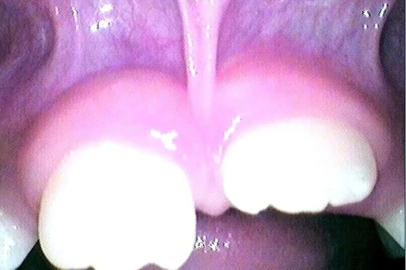 tongue_7.jpg