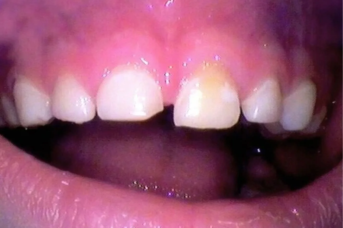 tongue_4.jpg