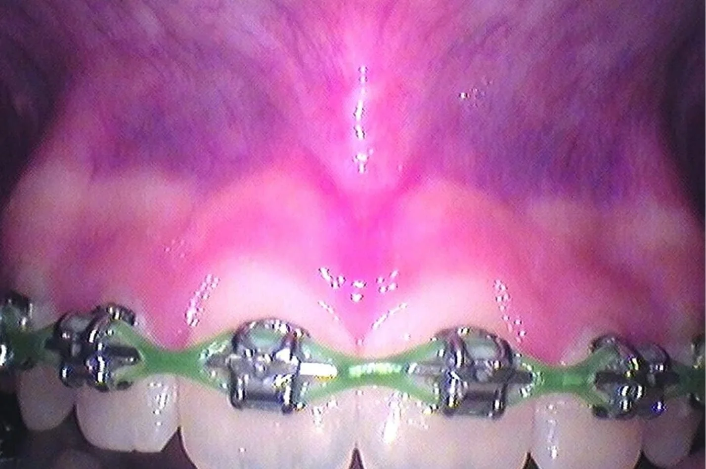 tongue_16.jpg
