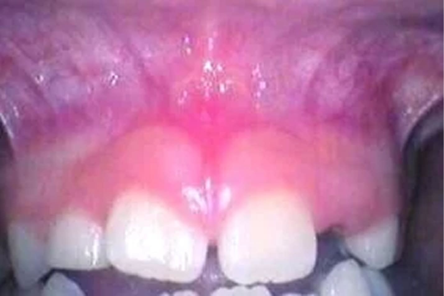 tongue_10.jpg
