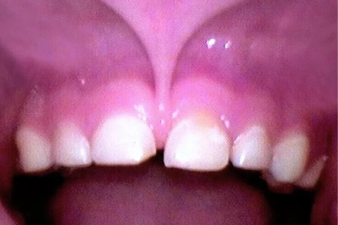 tongue_3.jpg