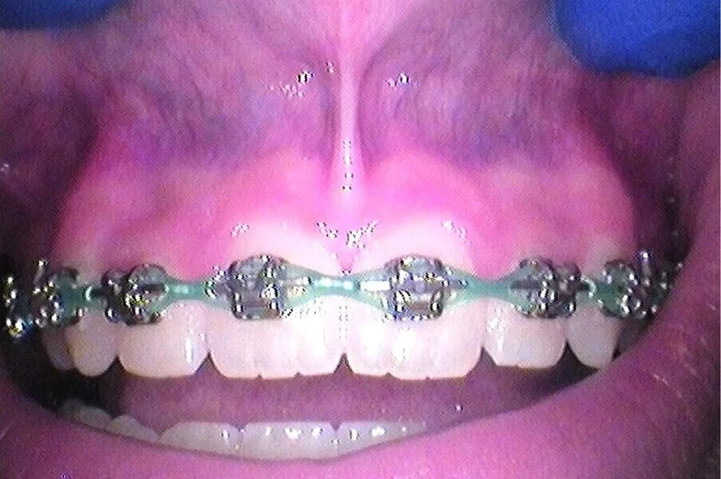 tongue_15.jpg