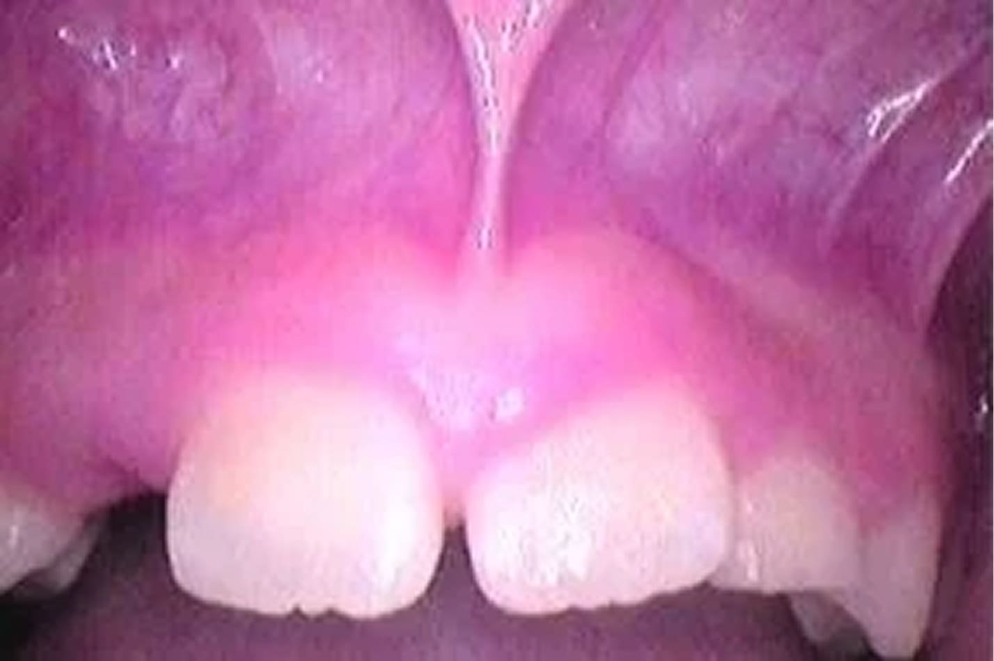 tongue_9.jpg