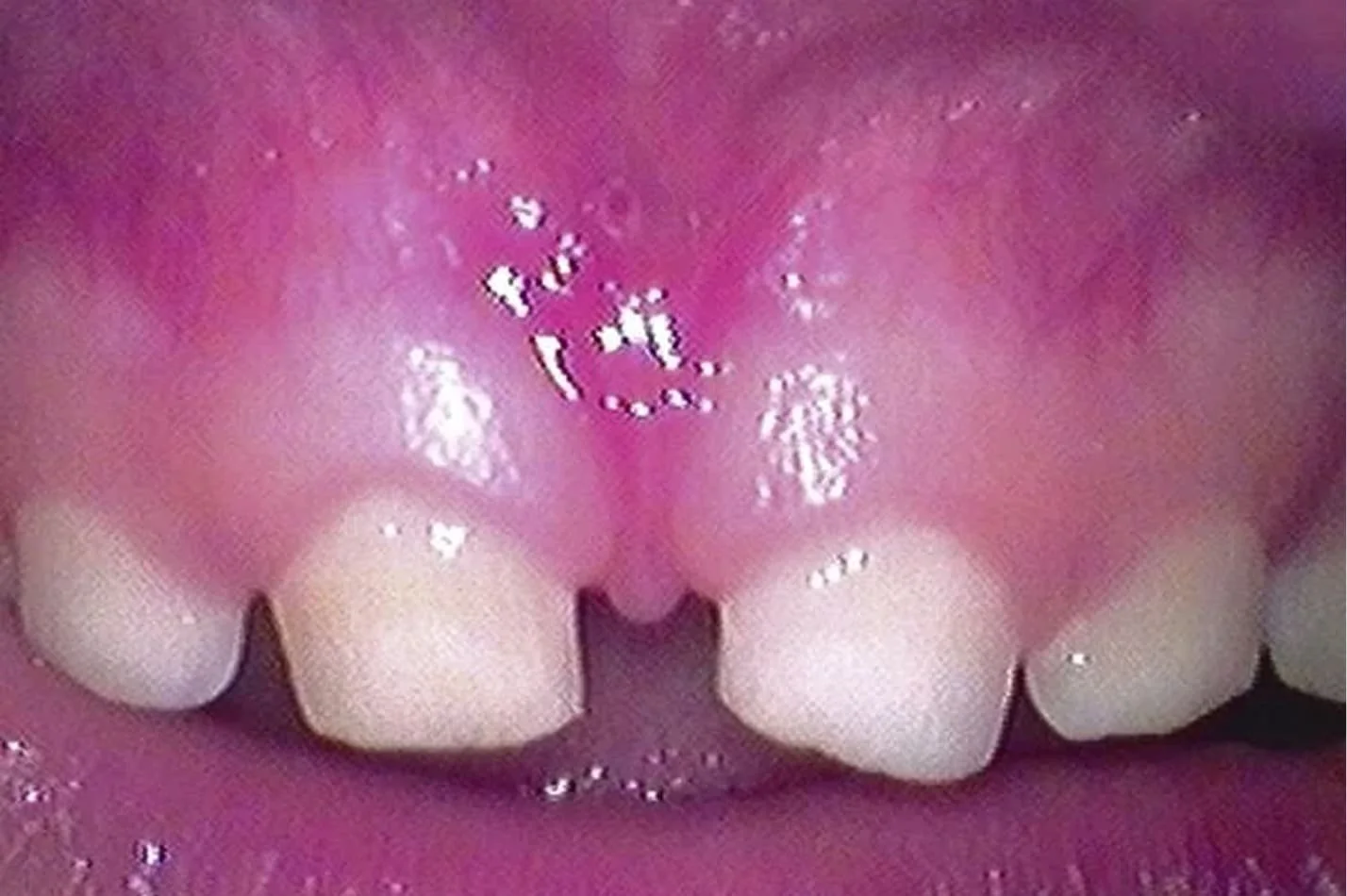 tongue_6.jpg