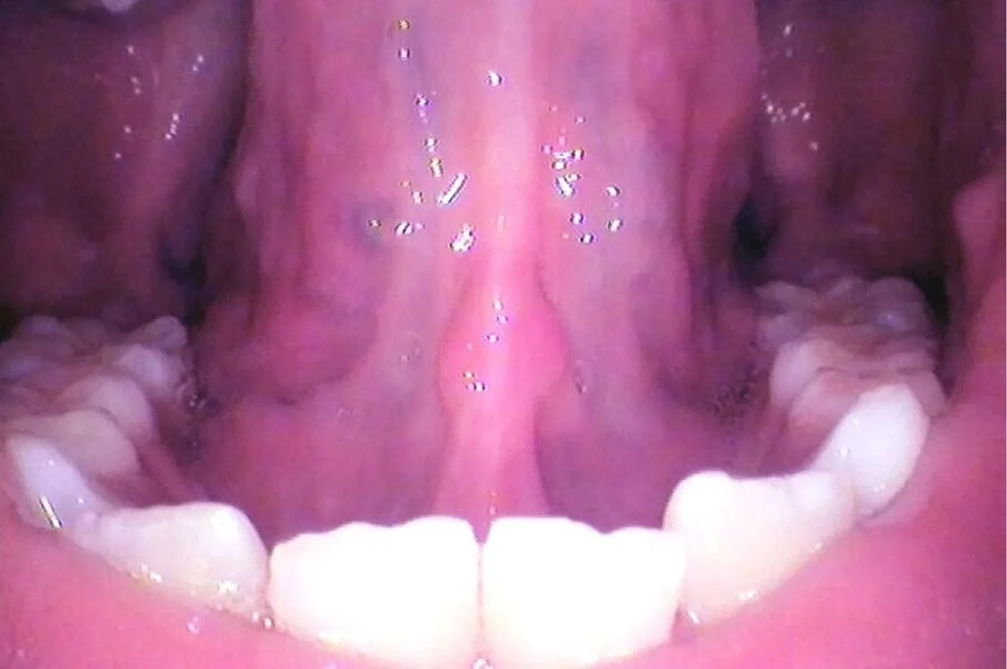 tongue_18.jpg