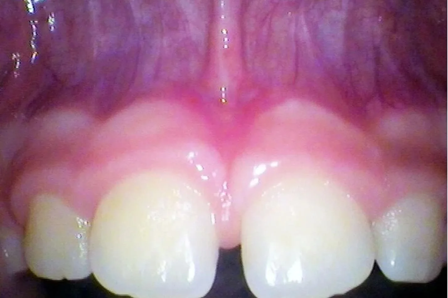 tongue_12.jpg