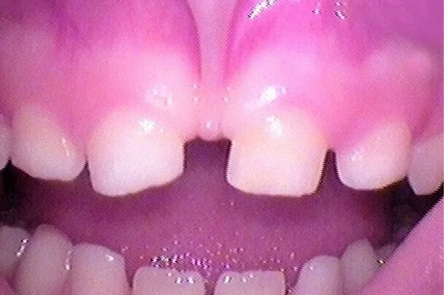 tongue_5.jpg