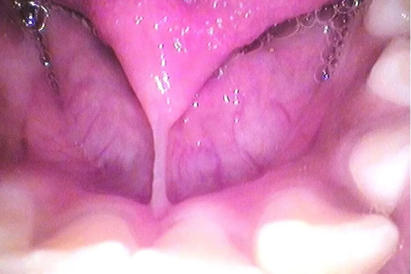 tongue_17.jpg