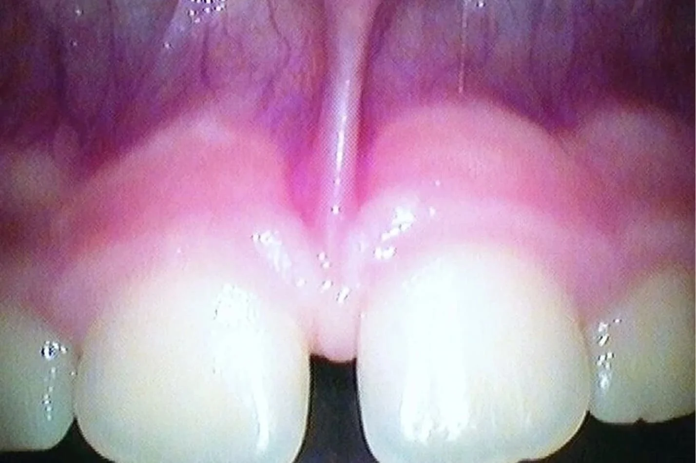 tongue_11.jpg