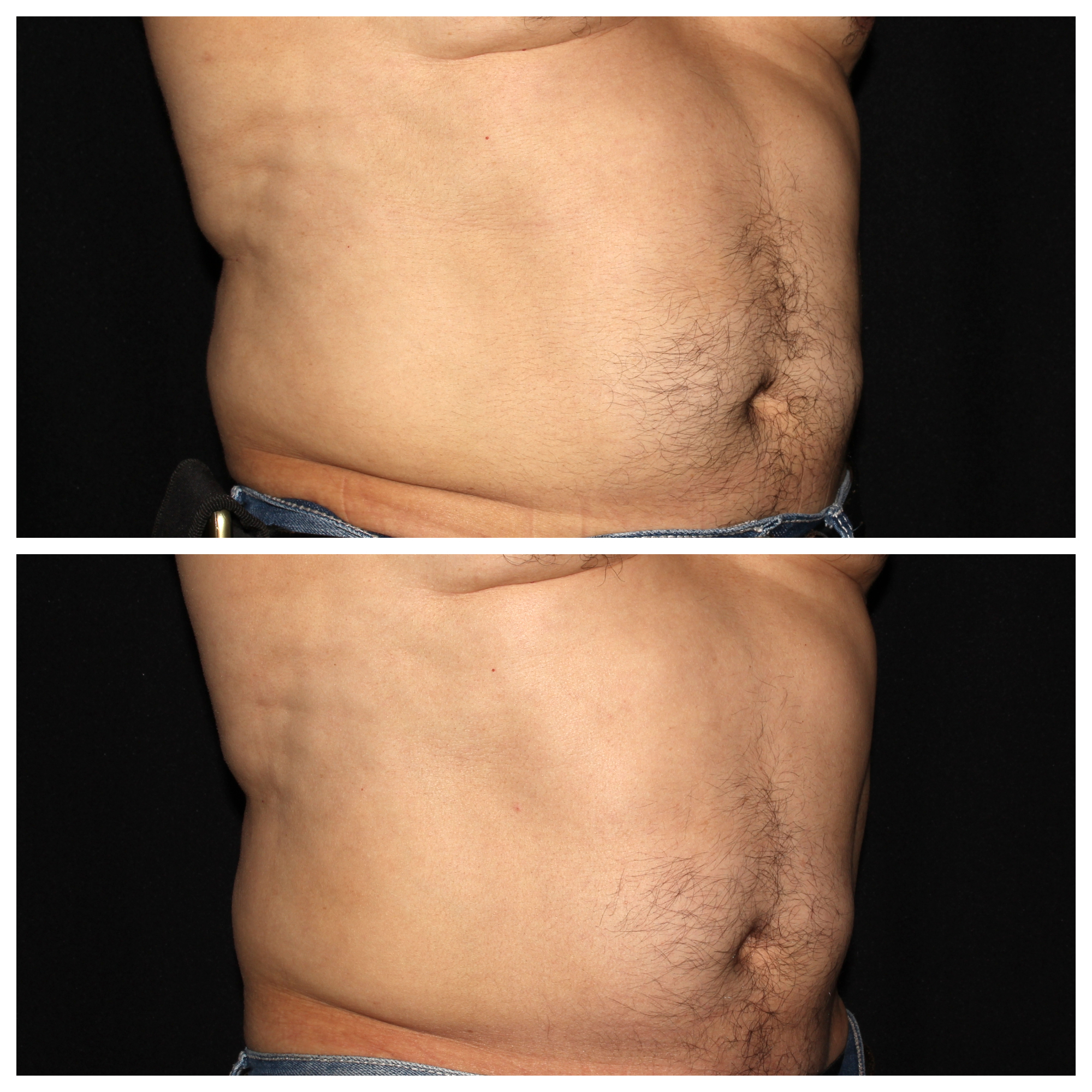 ABS CS.jpg