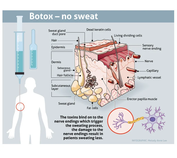 Botox-sweatgland-V2.jpg